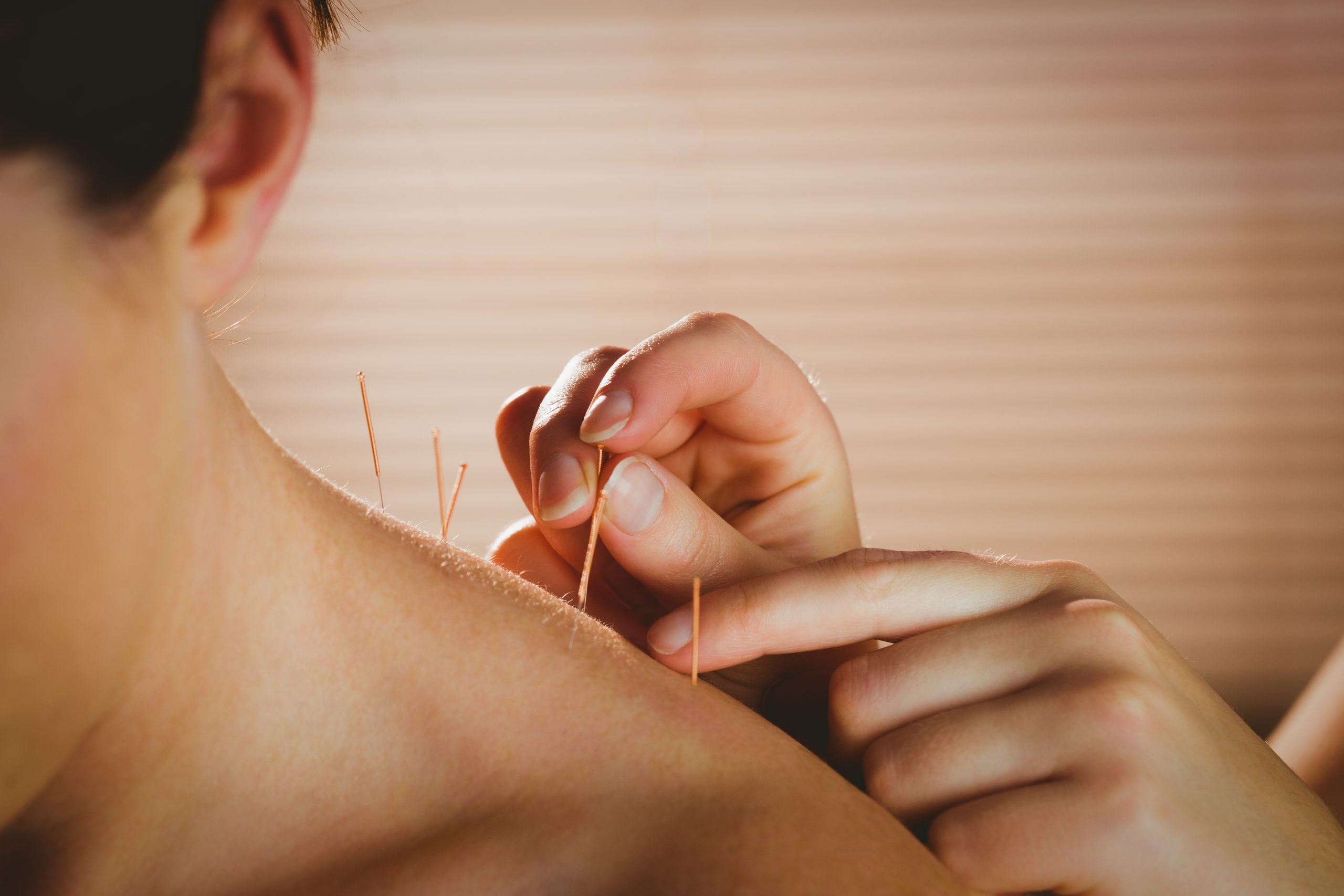 Hilft Akupunktur als Homöopathie bei Neurodermitis?